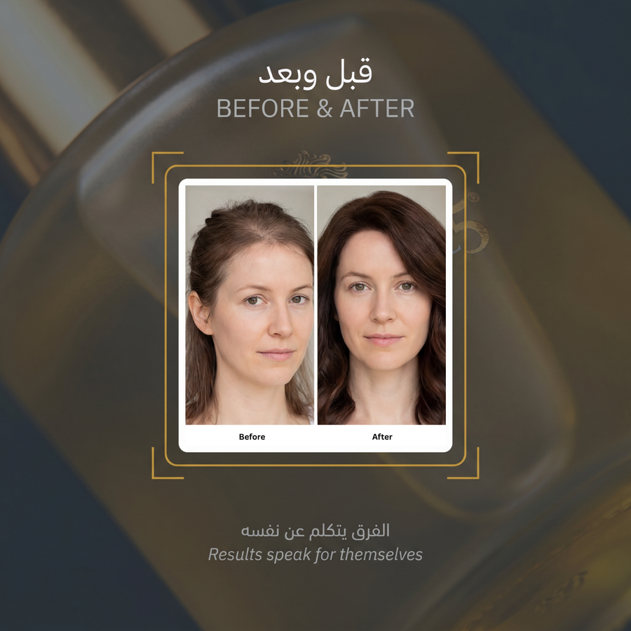 Hair Thickening & Revitalizing Set - image 6